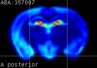 ABA expression energy