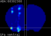 ABA expression energy