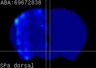 ABA expression energy