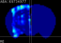 ABA expression energy