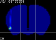 ABA expression energy