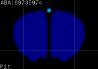 ABA expression energy