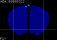 ABA expression energy