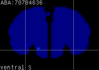 ABA expression energy