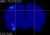 ABA expression energy