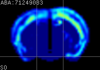 ABA expression energy