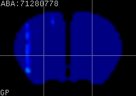 ABA expression energy