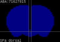 ABA expression energy