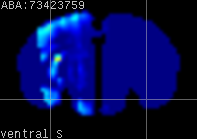 ABA expression energy