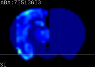 ABA expression energy