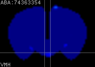 ABA expression energy