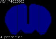 ABA expression energy