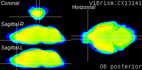 ViBrism