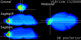 ViBrism
