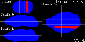 ViBrism