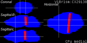 ViBrism