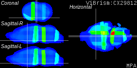 ViBrism