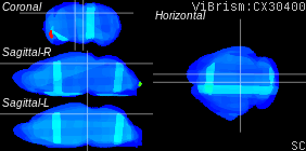 ViBrism
