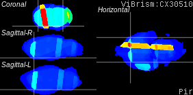 ViBrism