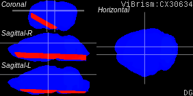 ViBrism