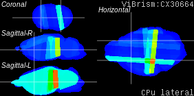 ViBrism