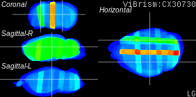 ViBrism