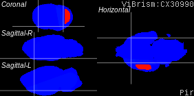ViBrism