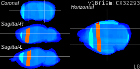ViBrism