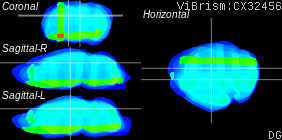 ViBrism