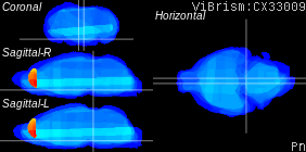 ViBrism