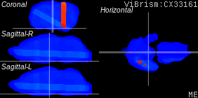 ViBrism
