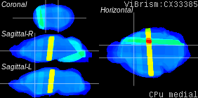 ViBrism