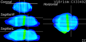 ViBrism