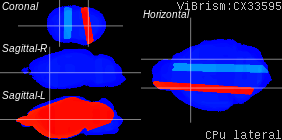 ViBrism