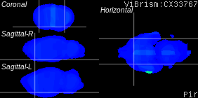 ViBrism