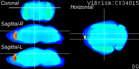 ViBrism