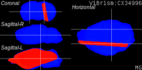 ViBrism