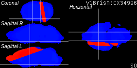 ViBrism