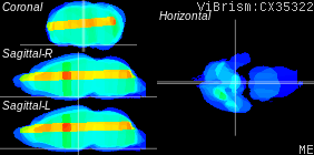ViBrism