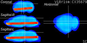 ViBrism