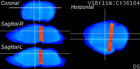 ViBrism