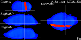 ViBrism