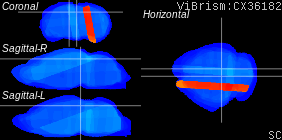 ViBrism