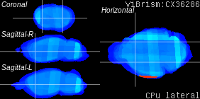 ViBrism