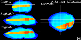 ViBrism